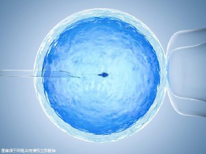 染色体易位案例